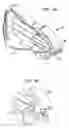 Fig. 04 - Clip and method for epicardial placement of temporary heart pacing electrodes