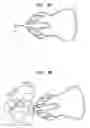 Fig. 06 - Clip and method for epicardial placement of temporary heart pacing electrodes