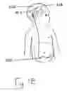 Fig. 04 - Method of treating a patient with hydrocephalus and apparatus therefor