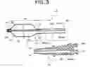 Fig. 03 - Intra-aortic balloon catheter