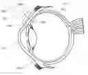 Fig. 01 - Ocular injection device and method