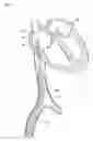 Fig. 06 - Catheter assembly