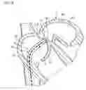 Fig. 07 - Catheter assembly