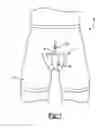 Fig. 02 - Incontinence collection device