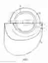 Fig. 02 - Ostomy appliance