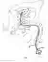 Fig. 02 - Rotate-to-advance catheterization system