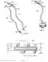Fig. 04 - Rotate-to-advance catheterization system