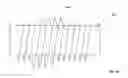 Fig. 28 - Rotate-to-advance catheterization system