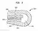 Fig. 04 - Implantable pump with infinitely variable resistor