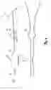 Fig. 06 - Apparatus and Method of Treating Urinary Incontinence by Heating Urethra