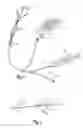 Fig. 08 - Apparatus and Method of Treating Urinary Incontinence by Heating Urethra