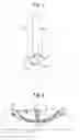 Fig. 02 - Electrosurgical Blade With Profile For Minimizing Tissue Damage