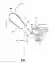 Fig. 02 - Arthoscopic method and apparatus for tissue attachment to bone