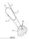 Fig. 06 - Arthoscopic method and apparatus for tissue attachment to bone