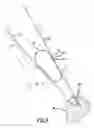Fig. 08 - Arthoscopic method and apparatus for tissue attachment to bone