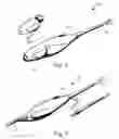 Fig. 04 - System and method for locating resorbable tissue fixation devices