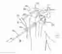 Fig. 01 - Method of minimally invasive shoulder replacement surgery