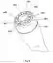 Fig. 09 - System for abrading skin to remove outer portions thereof