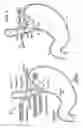 Fig. 02 - Apparatus and method for manipulating stomach tissue and treating gastroesophageal reflux disease