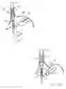 Fig. 06 - Apparatus and method for manipulating stomach tissue and treating gastroesophageal reflux disease