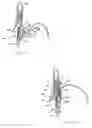 Fig. 07 - Apparatus and method for manipulating stomach tissue and treating gastroesophageal reflux disease