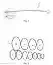 Fig. 02 - Subcutaneous tunneller