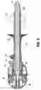 Fig. 06 - Adjustable trocar washer