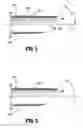 Fig. 03 - Beveled access apparatus with locking ribs elements