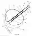 Fig. 04 - Infra-epidermic subcision device for blunt dissection of sub-epidermic tissues
