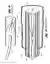 Fig. 02 - Removable vena cava filter having inwardly positioned anchoring hooks in collapsed configuration