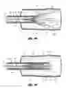 Fig. 08 - Removable vena cava filter having inwardly positioned anchoring hooks in collapsed configuration