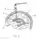 Fig. 02 - Central nervous system cooling catheter