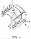 Fig. 02 - Anchoring system for implantable heart valve prostheses