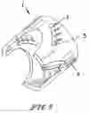 Fig. 04 - Anchoring system for implantable heart valve prostheses
