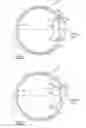Fig. 02 - Multi-component accommodative intraocular lens with compressible haptic