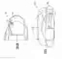 Fig. 04 - Multi-component accommodative intraocular lens with compressible haptic