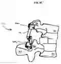 Fig. 09 - Non-linear artificial ligament system