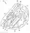 Fig. 01 - Tibial insert and associated surgical method