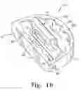 Fig. 09 - Tibial insert and associated surgical method