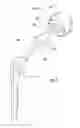 Fig. 02 - Intraoperative joint force measuring device, system and method