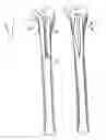 Fig. 10 - Hip stem for receiving intramedullary nail