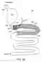 Fig. 03 - Gastrointestinal anchor compliance