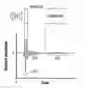Fig. 01 - Density log without a nuclear source