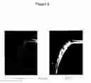 Fig. 10 - Mouse models of human prostate cancer