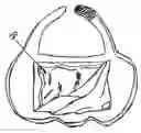 Fig. 01 - Protective bib with disposable wipe cloth