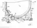Fig. 01 - Apparatus and method for attaching a drive system and a stand to a ring in a medicine gantry