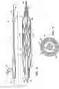 Fig. 04 - Method for retaining a vascular stent on a catheter
