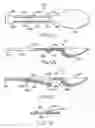 Fig. 02 - Clip-on utensils and methods of use thereof