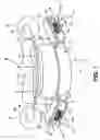 Fig. 02 - Method for treating sleep apnea