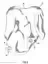 Fig. 04 - Method of selecting or identifying a surgical gown